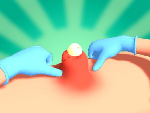 Gioco Stringere brufolo in linea
